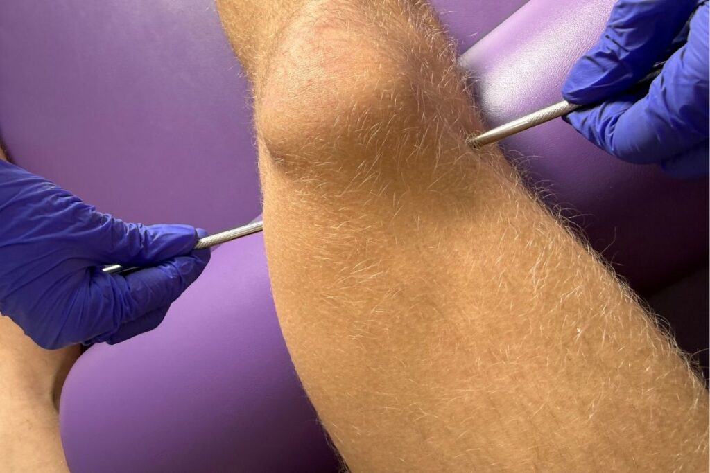 pinoterapia