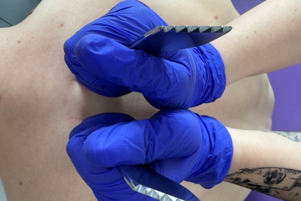 pinoterapia